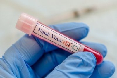 Kerala woman tests positive for Nipah